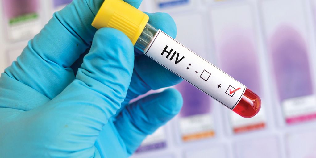 Rising cases of STDs prompt for new infection control efforts - Vimarsana News