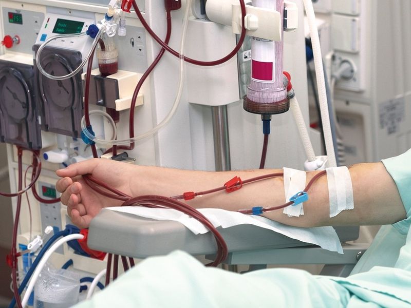 Fresenius shifts management structure for new global care strategy - Vimarsana News